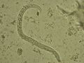 Aelurostrongylus abstrusus klein.jpg