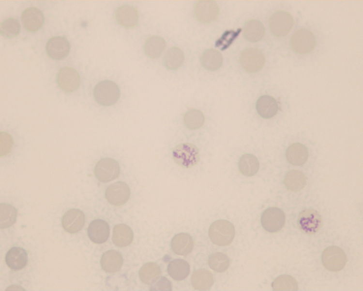 Datei:Retikulozyten 019.jpg